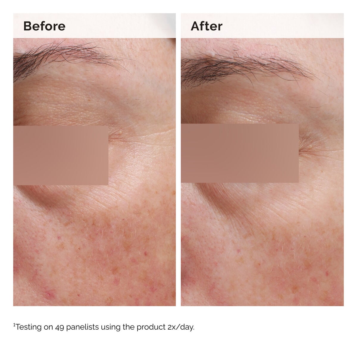 niacinamide-5-face-and-body-emulsion-c6 2024-08-23-ORD-Nia-5pct-Face-Body-B-A-Elasticity-Global-02-1x1.jpg