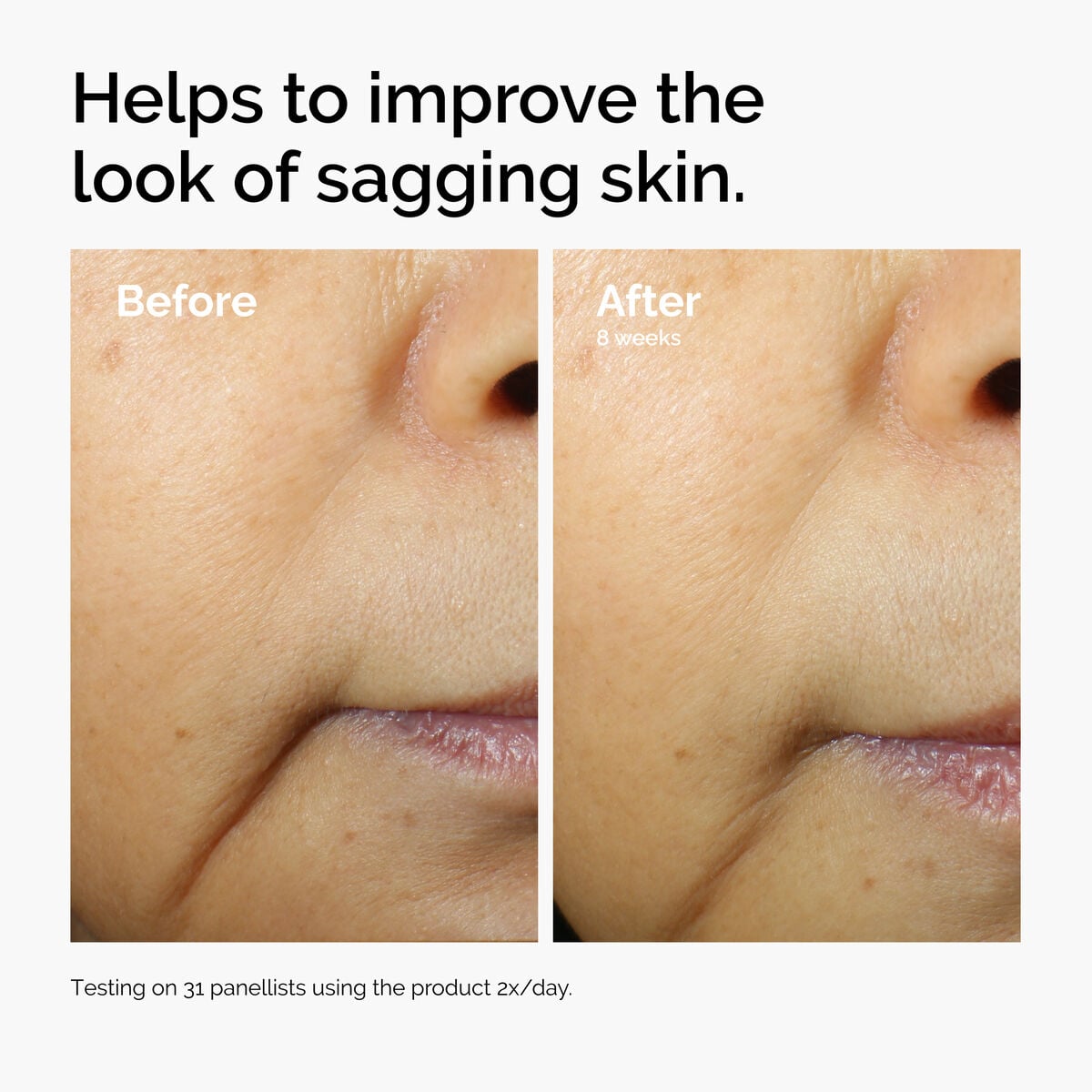 caffeine-3-escin-1-face-serum-e0 ord-caffeine-3pct-escin-1pct-face-serum-before-after-sagging.jpg