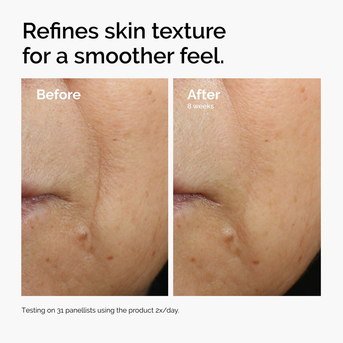 caffeine-3-escin-1-face-serum-e0 ord-caffeine-3pct-escin-1pct-face-serum-before-after-texture.jpg