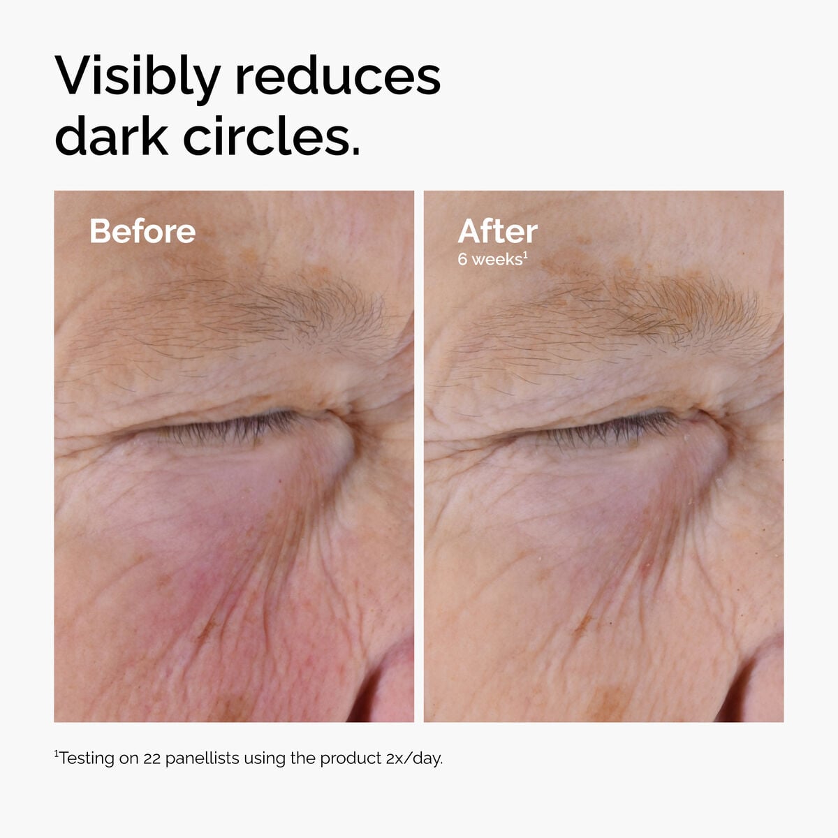 caffeine-solution-5-egcg-eye-serum-r2 ord-caffeine-solution-egcg-dark-circles-before-after.jpg