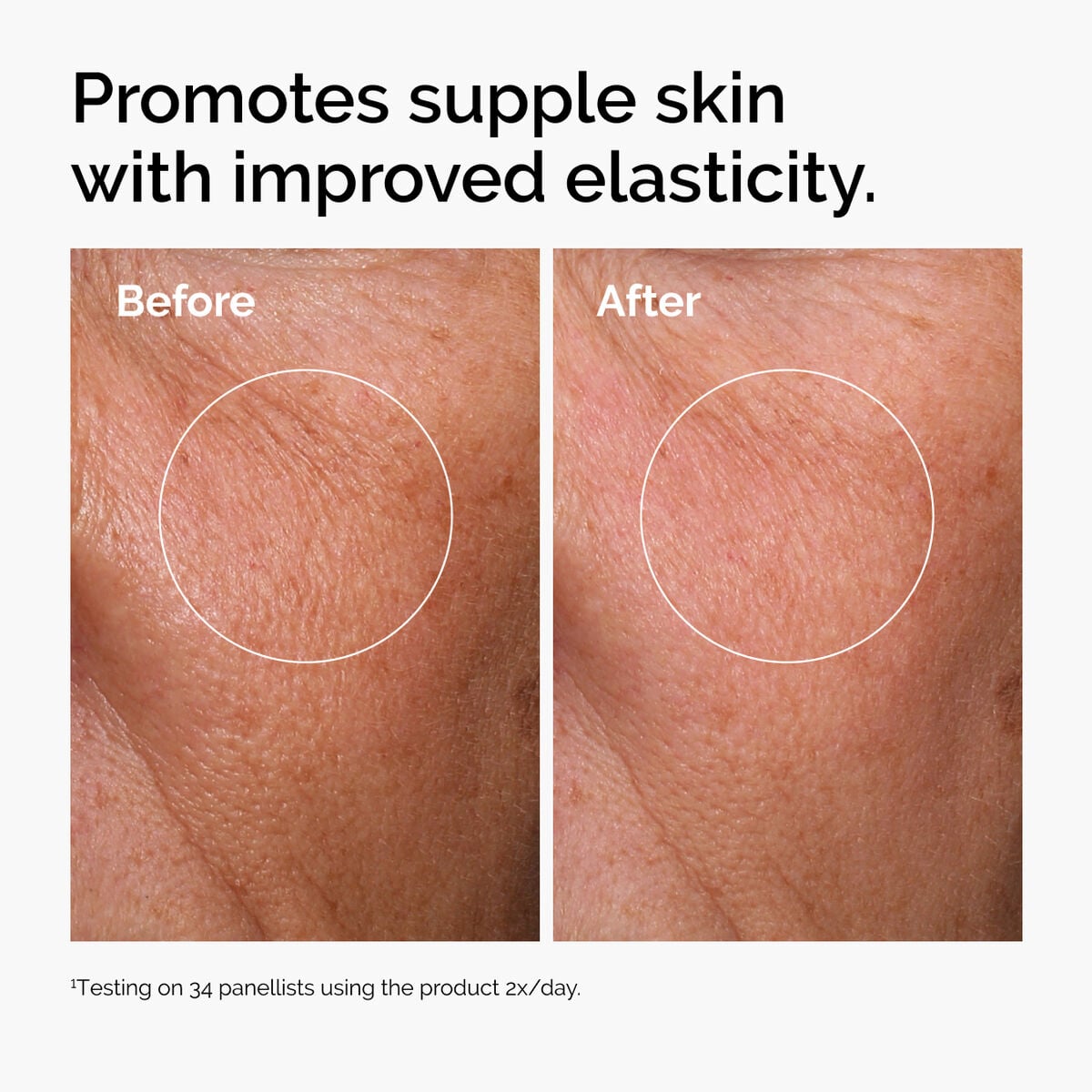 hyaluronic-acid-2-b5-with-ceramides-a8 ord-hyaluronic-acid-2pct-b5-hydrating-serum-before-after-elasticity.jpg