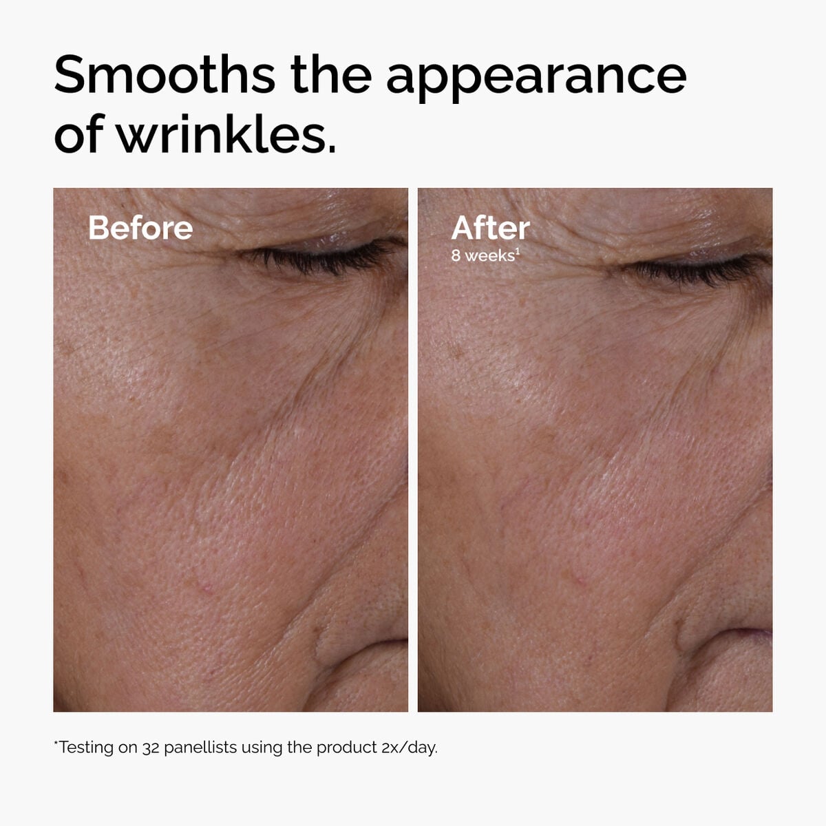 multi-peptide-ha-serum-a1 ord-multi-peptide-ha-serum-wrinkles-before-after.jpg