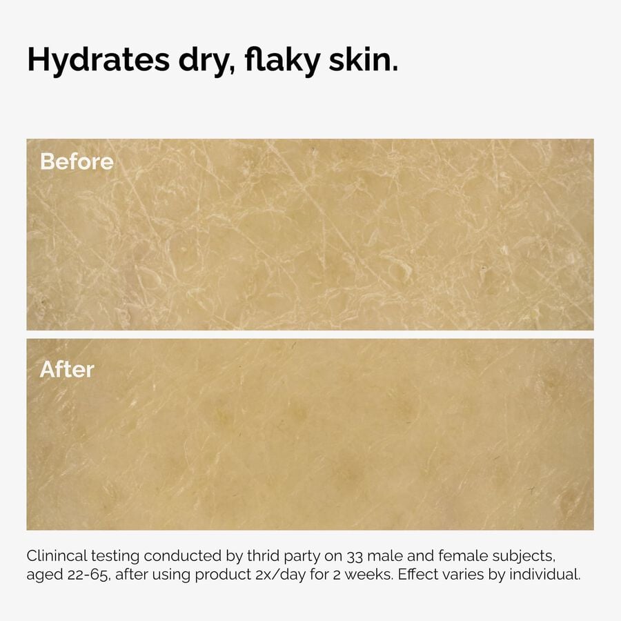 the-body-care-collection-e5 ord-natural-moisturizing-factors-inulin-body-before-after-graphic-02.jpg