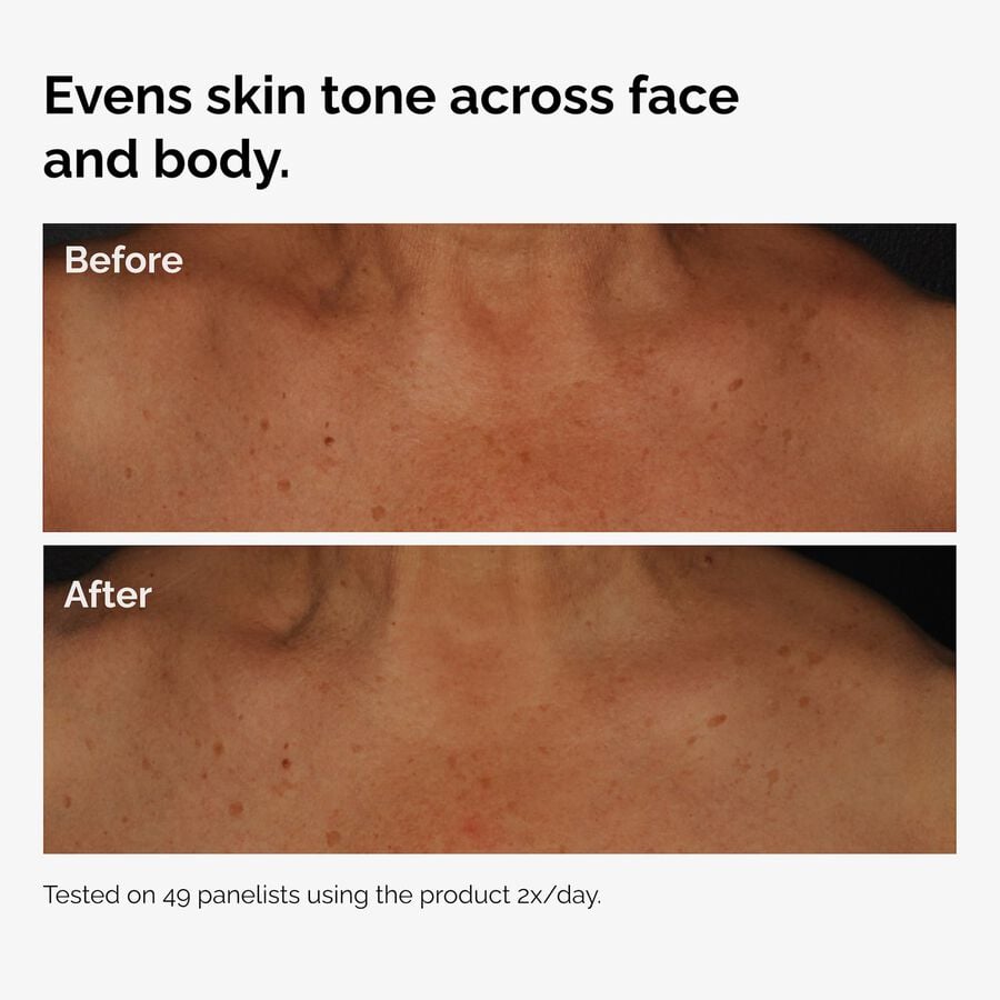 the-body-care-collection-e5 ord-niacinamide-face-body-serum-before-after-even-tone-graphic.jpg